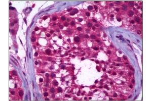 Human Testis: Formalin-Fixed, Paraffin-Embedded (FFPE) (CD81 anticorps)