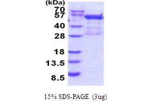 SDS-PAGE (SDS) image for Bromodomain Containing 2 (BRD2) (AA 1-455) protein (His tag) (ABIN5853962) (BRD2 Protein (AA 1-455) (His tag))
