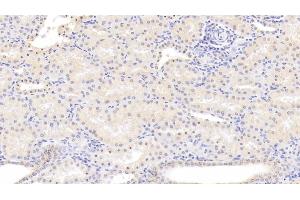 Detection of ALOX15 in Human Kidney Tissue using Monoclonal Antibody to Arachidonate-15-Lipoxygenase (ALOX15) (ALOX15 anticorps  (AA 170-312))
