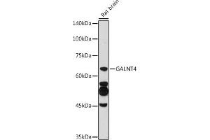 Western blot analysis of extracts of Rat brain, using G antibody (ABIN6135078, ABIN6140946, ABIN7101653 and ABIN7101654) at 1:500 dilution. (GALNT4 anticorps)