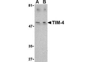 Western blot analysis of TIM-4 in Jurkat lysate with this product at (A) 1 and (B) 2 μg/ml. (TIMD4 anticorps  (C-Term))