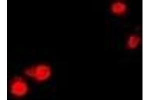 Immunofluorescent analysis of CTNNBL1 staining in U2OS cells.