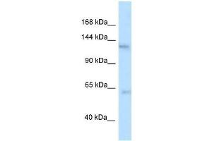 Western Blot showing Ttbk2 antibody used at a concentration of 1. (TTBK2 anticorps  (N-Term))
