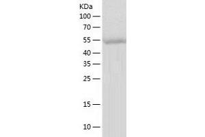 Western Blotting (WB) image for Glucosidase, Beta, Acid (GBA) (AA 40-536) protein (His-IF2DI Tag) (ABIN7123108)