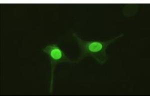 Anti-AK1 mouse monoclonal antibody (AK1) immunofluorescent staining of HeLa cells transiently transfected by pCMV6-ENTRY AK1 (RC215130). (Adenylate Kinase 1 anticorps)