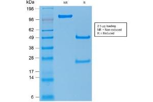 SDS-PAGE Analysis of Purified TP53 Mouse Recombinant Monoclonal Antibody ABIN6383817.