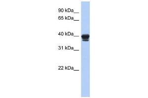 NAPE-PLD antibody used at 1 ug/ml to detect target protein. (NAPEPLD anticorps  (N-Term))