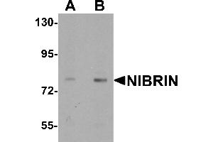 Western blot analysis of NIBRIN in rat lung tissue lysate with NIBRIN antibody at (A) 1 and (B) 2 µg/mL. (Nibrin anticorps  (N-Term))