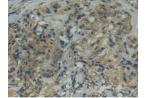 Figure. (ITGAD anticorps  (AA 879-1099))