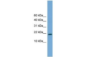WB Suggested Anti-Cited4 Antibody Titration:  0. (CITED4 anticorps  (Middle Region))