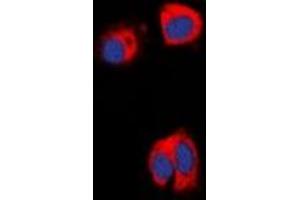 Immunofluorescent analysis of AAK1 staining in HepG2 cells.