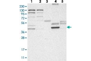 Western blot analysis of Lane 1: RT-4, Lane 2: U-251 MG, Lane 3: Human Plasma, Lane 4: Liver, Lane 5: Tonsil with HPDL polyclonal antibody .
