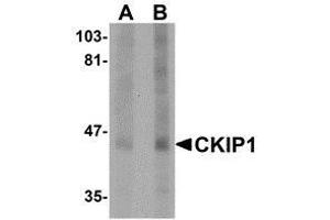 Western blot analysis of CKIP1 in human lung tissue lysate with AP30235PU-N CKIP1 antibody at (A) 1 and (B) 2 μg/ml. (PLEKHO1 anticorps  (C-Term))