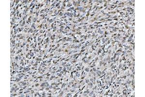 IHC analysis of ARL6IP6 using anti-ARL6IP6 antibody (ABIN7603020).