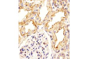 Immunohistochemical analysis of paraffin-embedded H. (ATF6B anticorps  (C-Term))