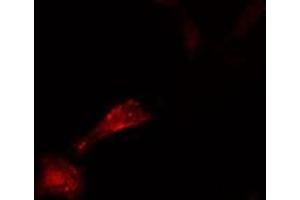 ABIN6276576 staining  HeLa cells by IF/ICC. (CDC25A anticorps  (N-Term))