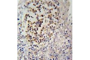 Immunohistochemistry analysis in human tonsils tissue (formalin-fixed, paraffin-embedded) using IL12RB2  Antibody (C-term), followed by peroxidase conjugation of the secondary antibody and DAB staining.