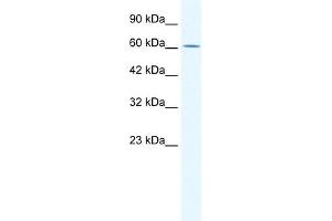 WB Suggested Anti-ZNF21 Antibody Titration:  0. (ZNF182 anticorps  (Middle Region))