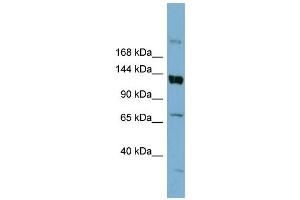 WB Suggested Anti-ABCB4  Antibody Titration: 0.