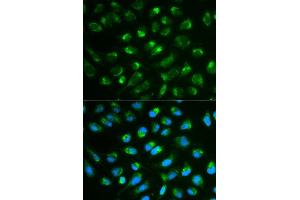 Immunofluorescence analysis of MCF7 cell using IL7 antibody. (IL-7 anticorps  (AA 26-177))