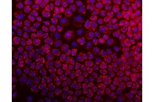 IF analysis of DARS2 using anti-DARS2 antibody (ABIN6719279). (DARS2 anticorps  (AA 334-448))