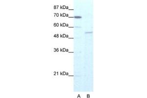 Western Blotting (WB) image for anti-Zinc Finger Protein 665 (ZNF665) antibody (ABIN2461274) (ZNF665 anticorps)