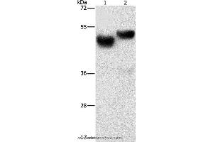 Western blot analysis of Human fetal brain and liver tissue, using AMZ1 Polyclonal Antibody at dilution of 1:1000 (AMZ1 anticorps)