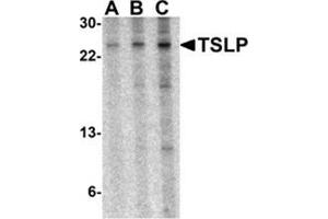 Western blot analysis of TSLP in A-20 cell lysate with AP30965PU-N TSLP antibody at 0. (Thymic Stromal Lymphopoietin anticorps  (Center))