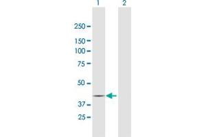 Western Blot analysis of RPTOR expression in transfected 293T cell line by RPTOR MaxPab polyclonal antibody.