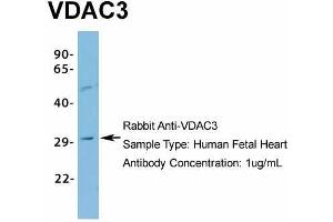 Host: Rabbit Target Name: VDAC3 Sample Type: Human Fetal Heart Antibody Dilution: 1.