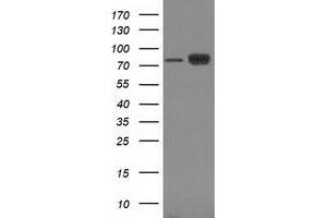 Image no. 5 for anti-Catenin (Cadherin-Associated Protein), beta 1, 88kDa (CTNNB1) antibody (ABIN1496890) (CTNNB1 anticorps)