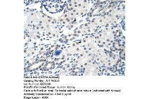 Rabbit Anti-SNRPA Antibody  Paraffin Embedded Tissue: Human Kidney Cellular Data: Epithelial cells of renal tubule Antibody Concentration: 4. (SNRPA1 anticorps  (Middle Region))