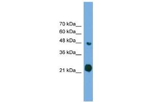 WB Suggested Anti-RAB37 Antibody Titration: 0. (RAB37 anticorps  (Middle Region))