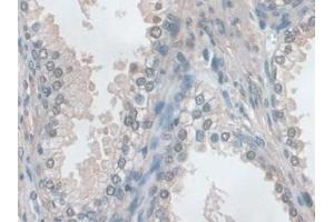 Detection of EZR in Human Prostate Tissue using Polyclonal Antibody to Ezrin (EZR)