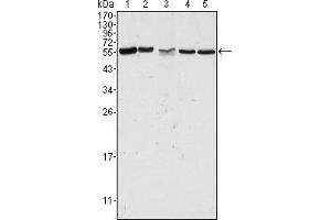 Western blot analysis using PAK2 mouse mAb against Hela (1), Jurkat (2), A549 (3), HEK293 (4) and K562 (5) cell lysate. (PAK2 anticorps)