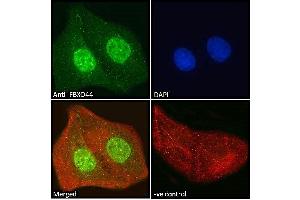 ABIN185065 Immunofluorescence analysis of paraformaldehyde fixed U2OS cells, permeabilized with 0.