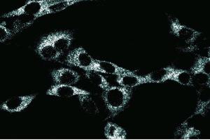 Immunoflourescence staining of RSV-3T3 cells. (NEDD4 anticorps  (AA 173-262))