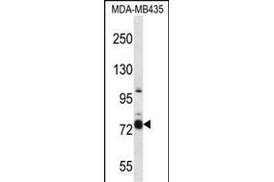 CASS4 Antibody (C-term) (ABIN657438 and ABIN2846469) western blot analysis in MDA-M cell line lysates (35 μg/lane). (CASS4 anticorps  (C-Term))