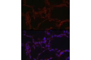 Immunofluorescence analysis of PC-12 cells using ZIP14 Rabbit pAb (ABIN6133191, ABIN6147993, ABIN6147994 and ABIN6214658) at dilution of 1:100 (40x lens).