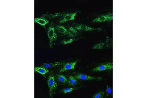 Immunofluorescence analysis of H9C2 cells using L1 antibody (ABIN6134555, ABIN6137248, ABIN6137250 and ABIN6215529) at dilution of 1:100.