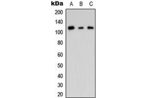 Western blot analysis of CNK2 expression in HEK293T (A), mouse Brain (B), rat brain (C) whole cell lysates. (CNKSR2 anticorps  (Center))