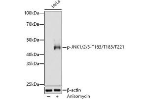 Western blot analysis of extracts of HeLa cells, using Phospho-JNK1/2/3-T183/T183/T221 antibody (ABIN6135251, ABIN6135990, ABIN6135991 and ABIN7101879) at 1:3000 dilution. (MAPK8/9/10 anticorps  (pThr183, pThr221, Thr183))