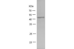 Western Blotting (WB) image for Cytochrome C Oxidase Subunit IV Isoform 1 (COX4I1) (AA 1-169) protein (GST tag) (ABIN7122572)