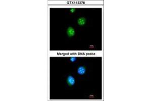 Image no. 3 for anti-Thyroid Hormone Receptor, beta (THRB) (AA 1-169) antibody (ABIN467595)