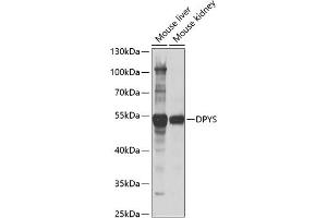 Western blot analysis of extracts of various cell lines, using DPYS antibody (ABIN6127809, ABIN6139809, ABIN6139810 and ABIN6221986) at 1:1000 dilution. (DPYS anticorps  (AA 250-519))
