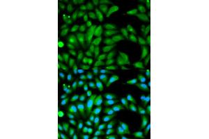 Immunofluorescence analysis of HeLa cells using PARK2 antibody (ABIN5970356). (Parkin anticorps)