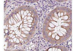 Phospho-AMPK alpha (Thr172) Antibody for IHC in human colon.