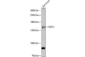 Western blot analysis of extracts of Rat brain, using NOS1 antibody (ABIN6129512, ABIN6144725, ABIN6144726 and ABIN6216548) at 1:500 dilution. (NOS1 anticorps  (AA 1-180))