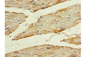 Immunohistochemistry of paraffin-embedded human skeletal muscle tissue using ABIN7142079 at dilution of 1:100 (PHPT1 anticorps  (AA 1-125))