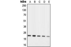 Western blot analysis of RPL10 expression in MCF7 (A), Jurkat (B), K562 (C), Raw264.